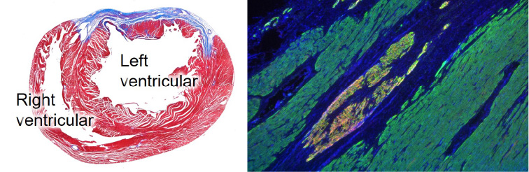 Unraveling the pathogenesis of heart failure and developing novel therapies