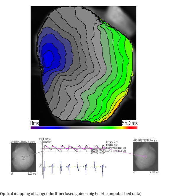 Basic Research on Arrhythmia Disorders