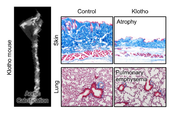 Understanding and Controlling Aging Mechanisms