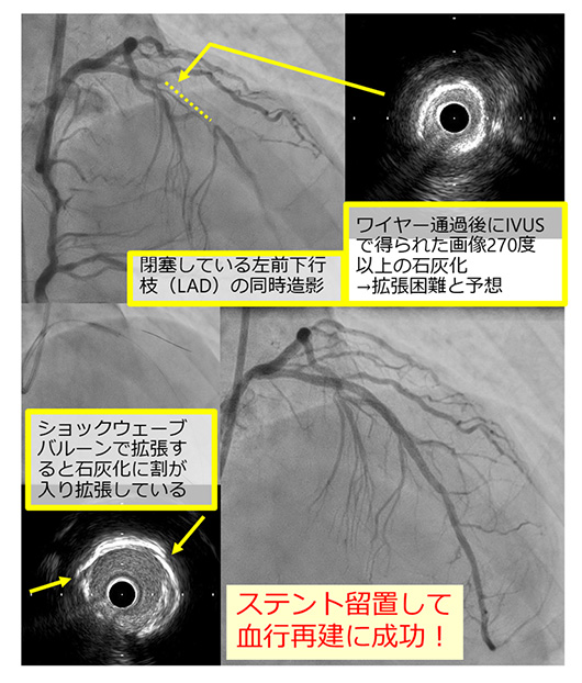 院内設備