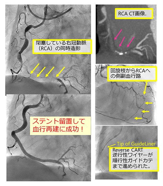 薬の写真