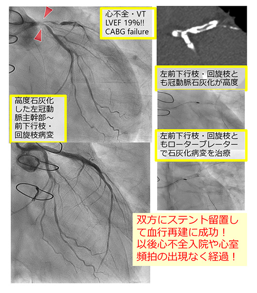 院内設備