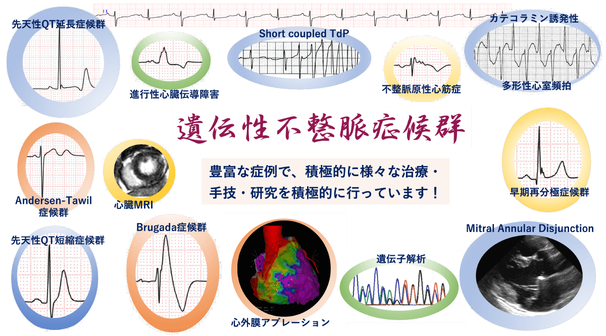 遺伝性不整脈症候群