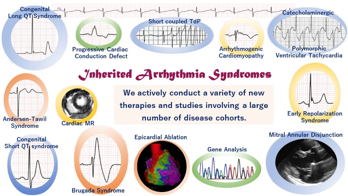 Inherited Arrhythmia Syndromes