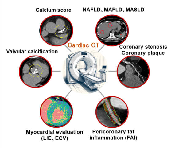 Clinical research using cardiac CT