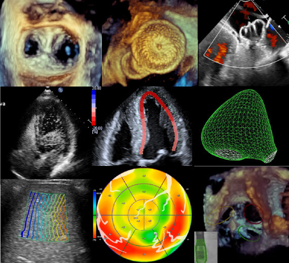 Echocardiographic Novel Challenge for Clinical Practice