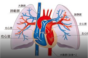 肺高血圧症