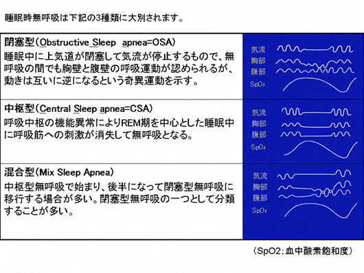 睡眠時無呼吸症候群の種類